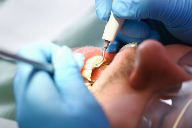 Best Broken Tooth Emergency  in Grasonville, MD